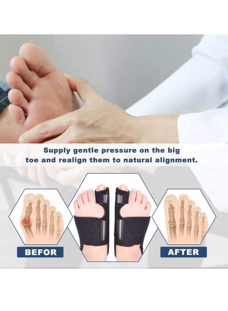 جبيرة تقويم إبهام القدم، مقوم إبهام القدم الكبير، مقوم إبهام القدم الكبير غير جراحي، مقوم إبهام القدم المطرقية، مقوم لتخفيف الألم، مناسب للرجال والنساء - Image 4